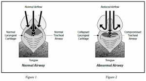 brachycephalic-syndrome-1